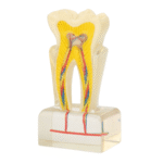 PROF 6x Magnified Dental Nerve Model - Image 2