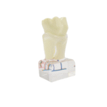 PROF 6x Magnified Dental Nerve Model - Image 3